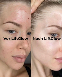 LiftGlow – EMS & LED Face Lifter